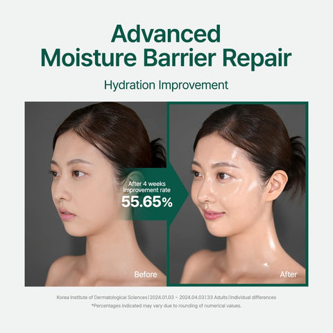 Purito Seoul Acne Removal Cream